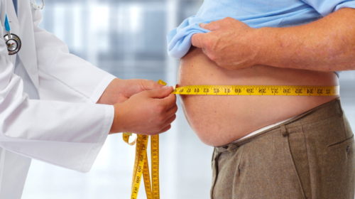 Studie: Tři čtvrtiny starších 50 let v nemocnici s covidem mělo nadváhu