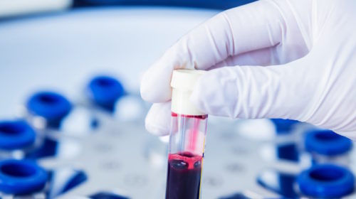 výzkum zdravotnictví krev test