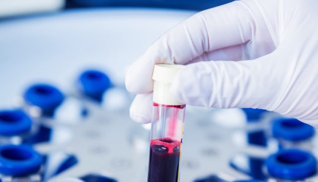 výzkum zdravotnictví krev test