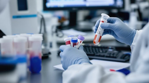 Význam krevních testů při detekci zánětů