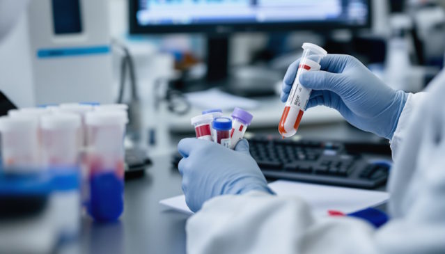 Význam krevních testů při detekci zánětů